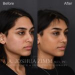 1 Mo R3.4V