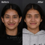 1 Yr FPS 1