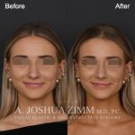 123 Frontal