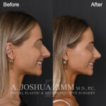 123 Right Lateral Watermarked
