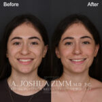 124 Frontal Smiling