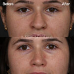 1yr Closeup
