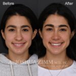 3 Month FPS