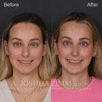 3 Months FPS 1