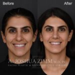 3 Months FPS
