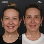 3 Months FPS