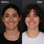 3 Months FPS 3