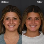 3 Months FPS 4