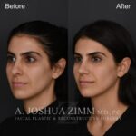 3 Months L3.4V 1