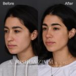 3 Months L3.4V