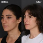 3 Months L3.4V 3