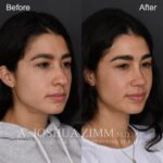3 Months R3.4V