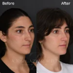 3 Months R3.4V 3