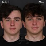3 Mo FPNS 1 1