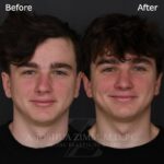 3 Mo FPS 1 1