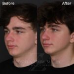 3 Mo L3.4V 1 1
