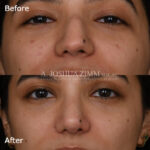 3 Months Close Up