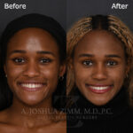 3 Months FPS 1 1