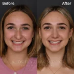3 Months FPS 1