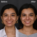 3 Months FPS 3