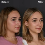 3 Months R3.4V 1