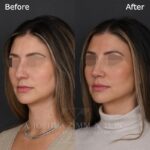 5mo L3.4V