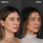 5mo R3.4V