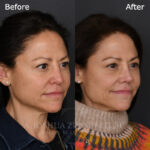 6 3 Mo Post Revision R3.4V