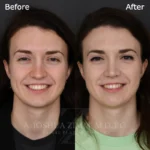 6 Mo FPS