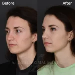 6 Mo L3.4V