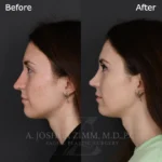 6 Mo LPNS