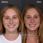 6 Months FPS