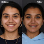 6 Months FPS 1
