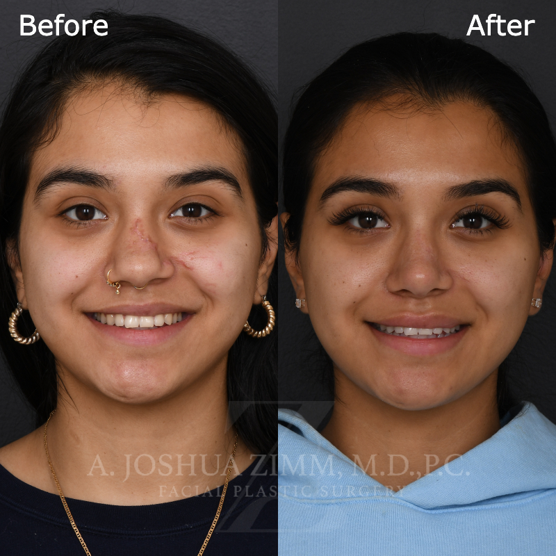 6 Months FPS 1