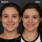 6 Months FPS 2