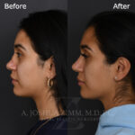 6 Months LPNS 1