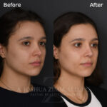 6 Months R3.4V 2