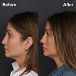 7mo 3wks LPNS