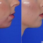 Chin20171 1