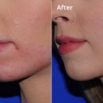 Chin20173 1