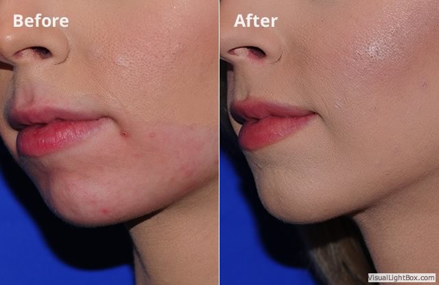 Chin20173 1