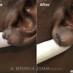 Earslotrepair20181