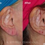 Earslotrepair20182