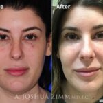 Facetite20181