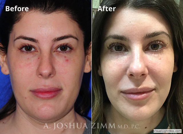 Facetite20181