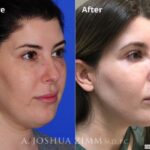 Facetite20182