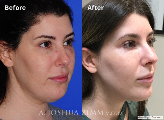 Facetite20182