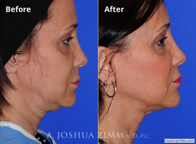 Facetite20184