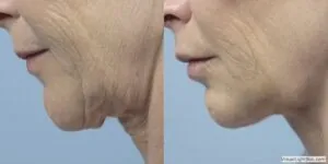 Facetite20188 300x150.jpg