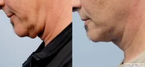 Facetite20189 300x138.jpg